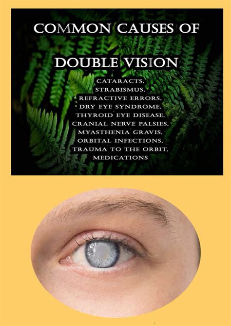 what medications can cause double vision.